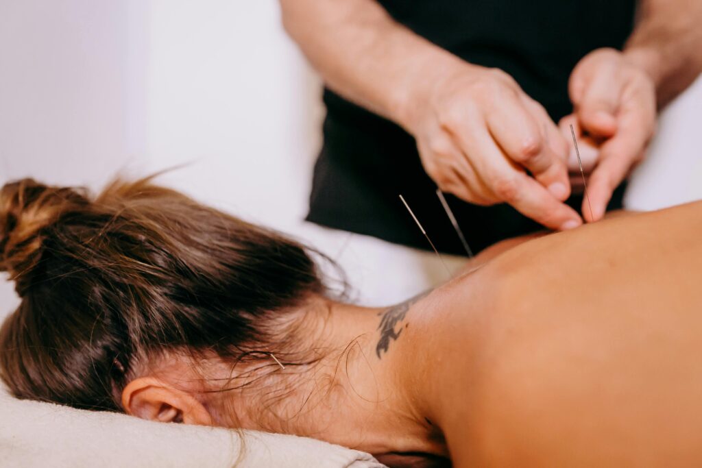 Acupuncture obstétricale pratiguée par la sage-femme pour soulager les futures mamans durant la grossesse. 